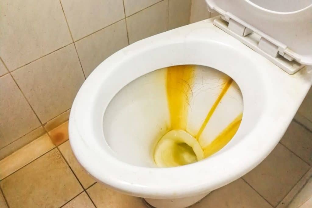 How To Remove Ring Around Toilet